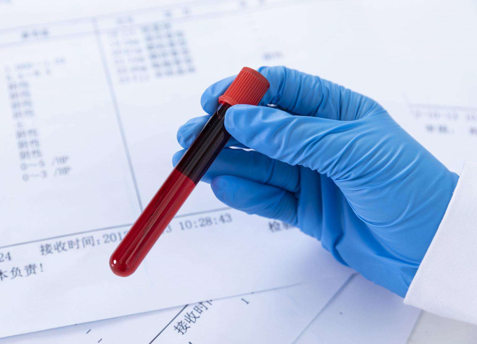 亲子鉴定几百块能做?这些真相你必须知道!