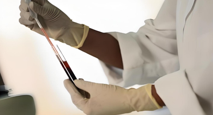 梅州亲子鉴定上户口