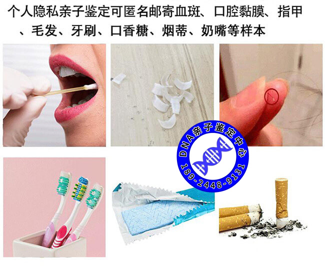 头发VS指甲，用哪个做亲子鉴定比较好？